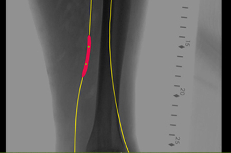 X-Ray Annotation